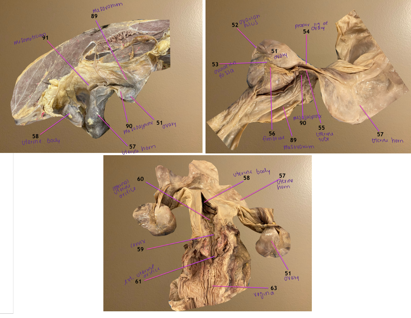 <ol start="59"><li><p>cervix</p></li><li><p>internal uterine orifice: entrance of cervix</p></li><li><p>external uterine orifice: exit of cervix </p></li></ol><p></p>