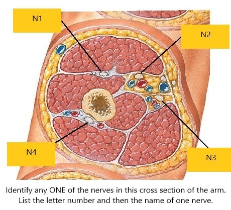<p>Identify N1-N4 (Arm)</p>