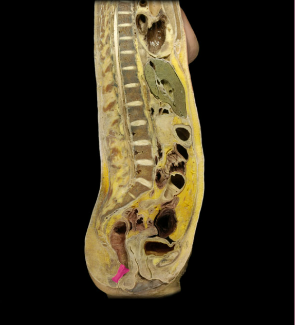 <p>what organ is this</p>