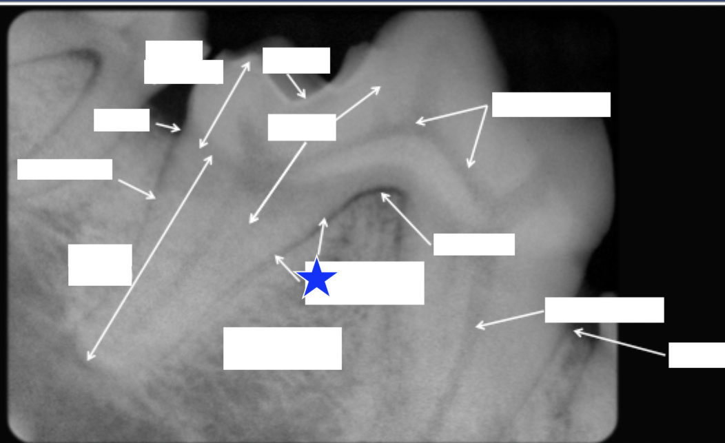 <p>What part of the tooth is indicated by the star (both arrows)?</p>
