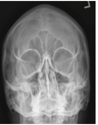 <p>PA Caldwell skull</p>