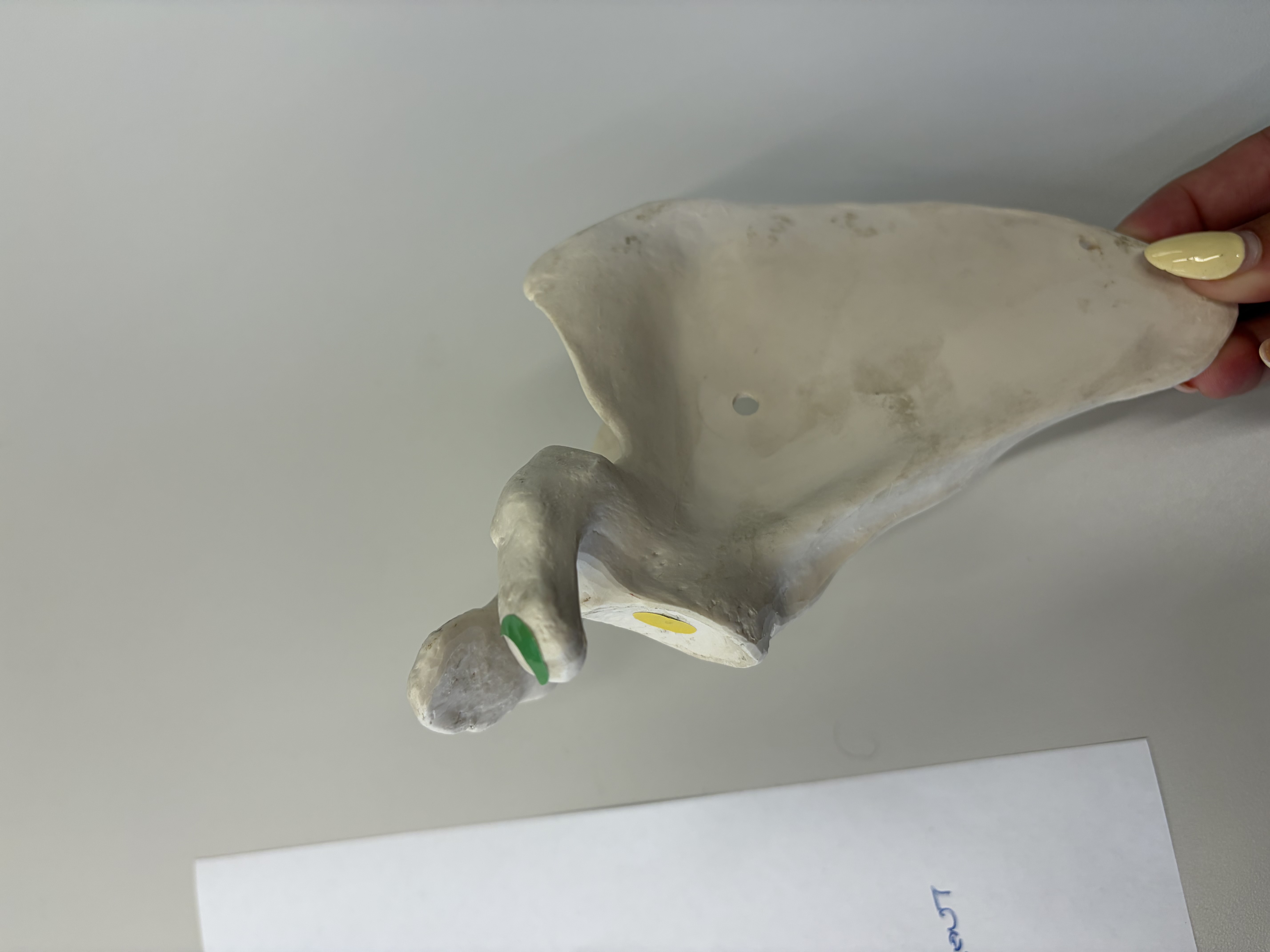 <p>What is this bone?</p><p>Yellow: Name this structure </p><p>Green: List one muscle that has a distal point of attachment here</p>