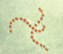 <p><span>Based on shape, what is the most likely name for the bacteria pictured below?</span></p>