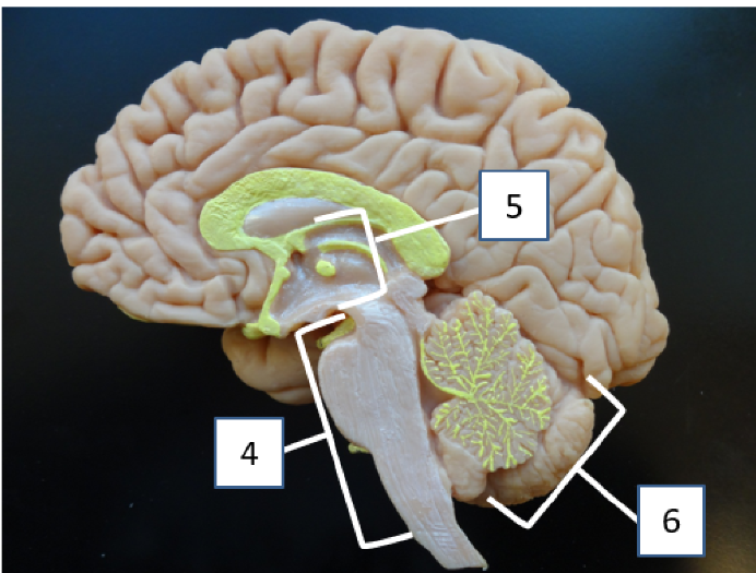 <p>What structure is #6</p>
