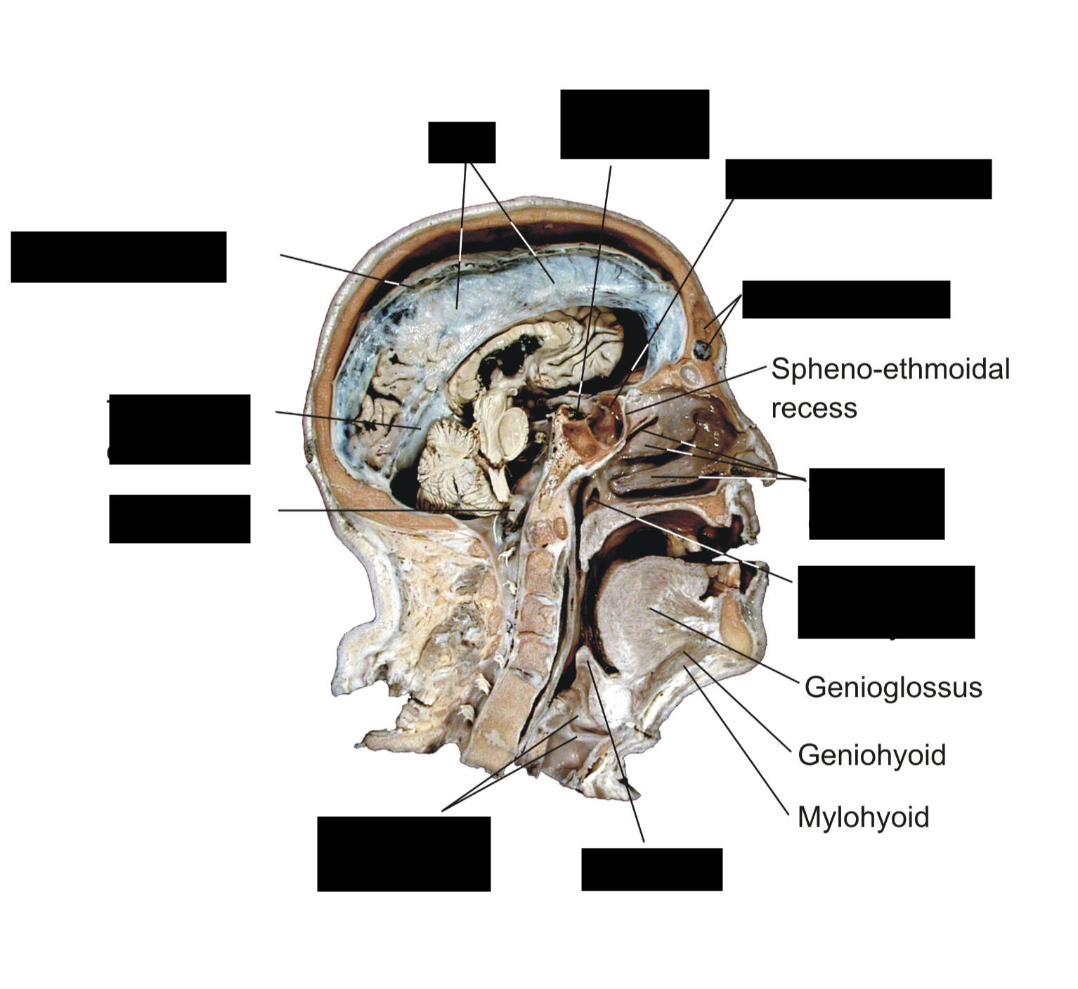 term image