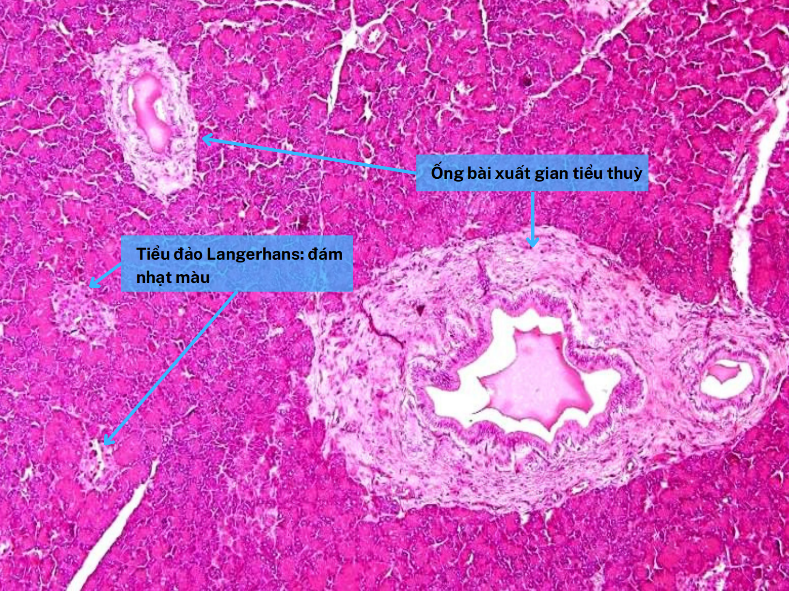<p>Ống bài xuất trong tiểu thuỳ của tuỵ</p>
