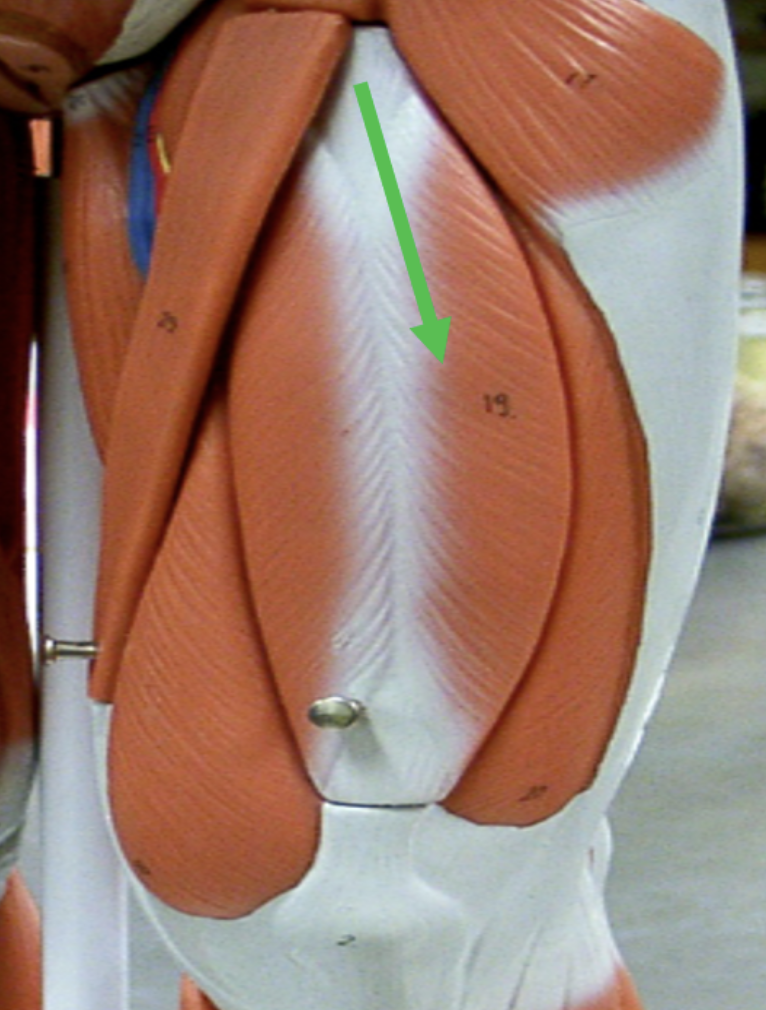 <p>Identify the muscle indicated by the pointer.</p>