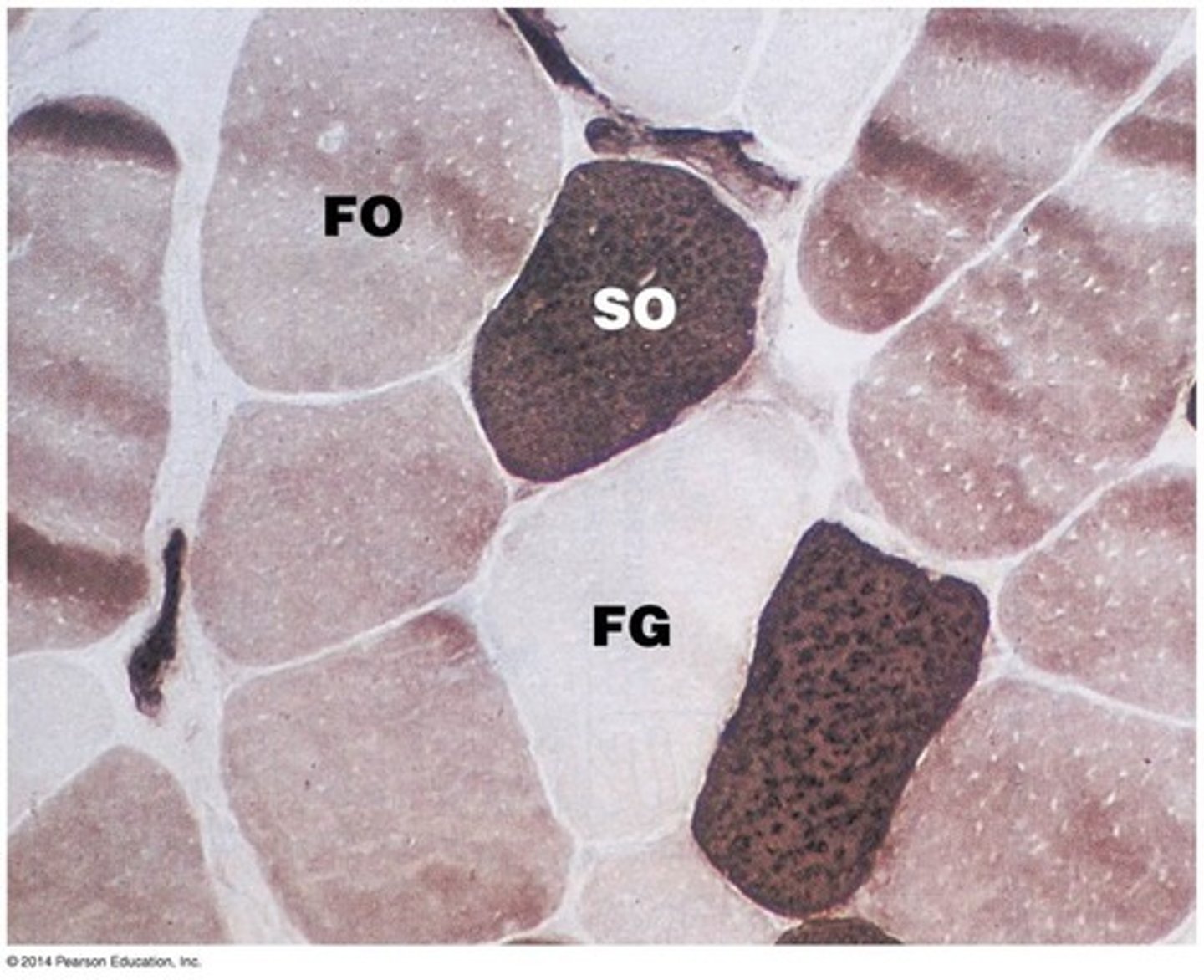 <p>Red, fatigue-resistant fibers using aerobic respiration.</p>