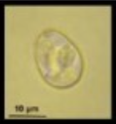 <p>Eimeria acervulina</p>