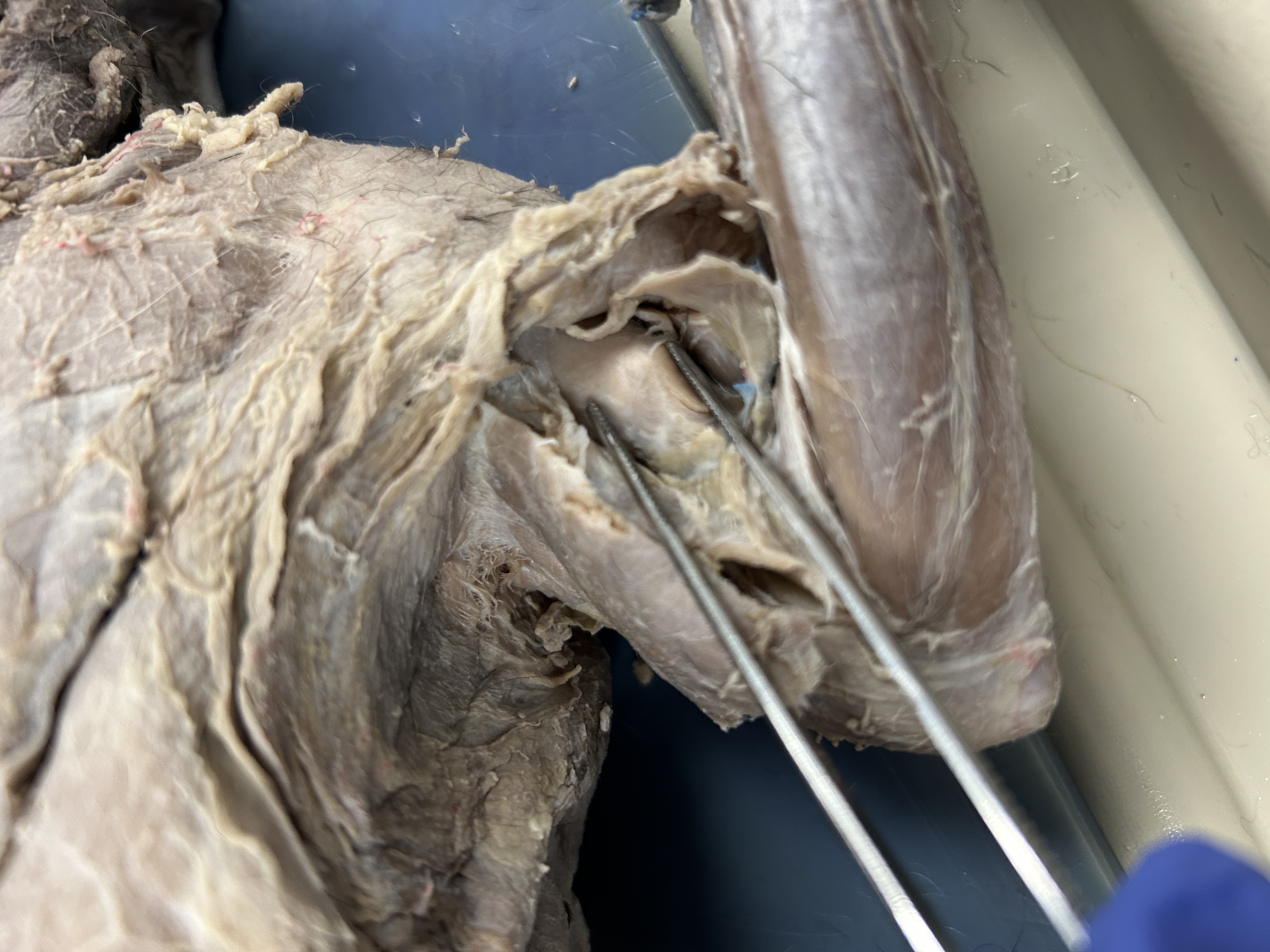 <p>Bicep Brachii </p>