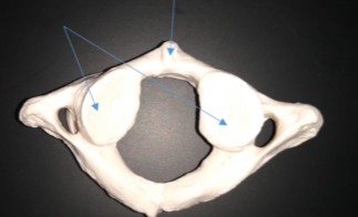 <p>What are these two arrows pointing at?</p>