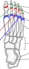 <p>ID joints (green)</p>