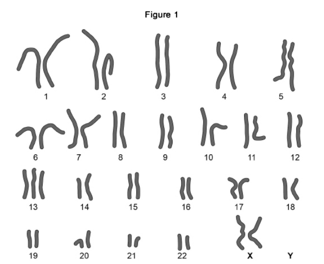 <p>Patau syndrome is a condition caused by a mutation affecting chromosome number. All the cells of the body will have this mutation. <strong>Figure 1 </strong>shows the chromosomes from one of the cells of a female who has Patau syndrome. </p><p>What is the effect of Patau syndrome on the chromosomes of this female? (1) </p>