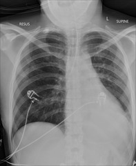 <p>During patient preparation, what must be removed?</p>