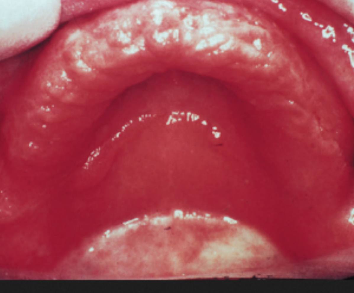 <p>• Name of lesion:</p><p>• Causative organism:</p><p>• Describe the lesion:</p>