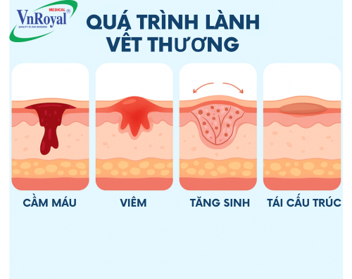 <ol><li><p>cầm máu</p></li><li><p>viêm</p></li><li><p>tăng sinh</p></li><li><p>tái tạo</p></li></ol><p></p><p></p>