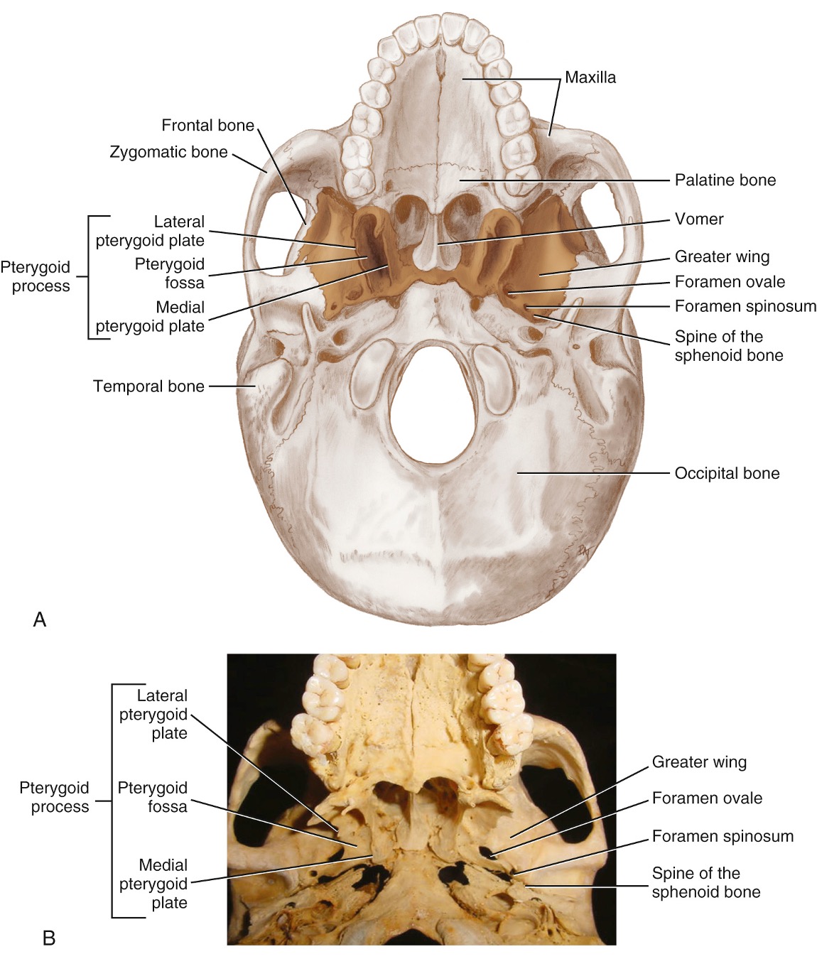 <p>Pterygoid Process</p>