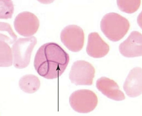 <p>name the type of RBC inclusion</p>