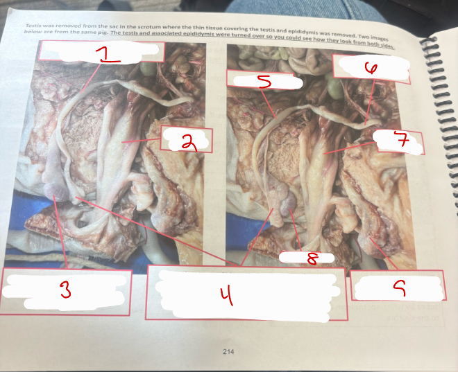 <p>Male Urogenital System 4</p>