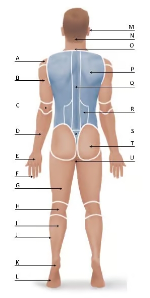 <p>what region is P?</p>