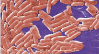 <p>Source of contamination/Reservoir in <strong>Salmonella</strong></p>