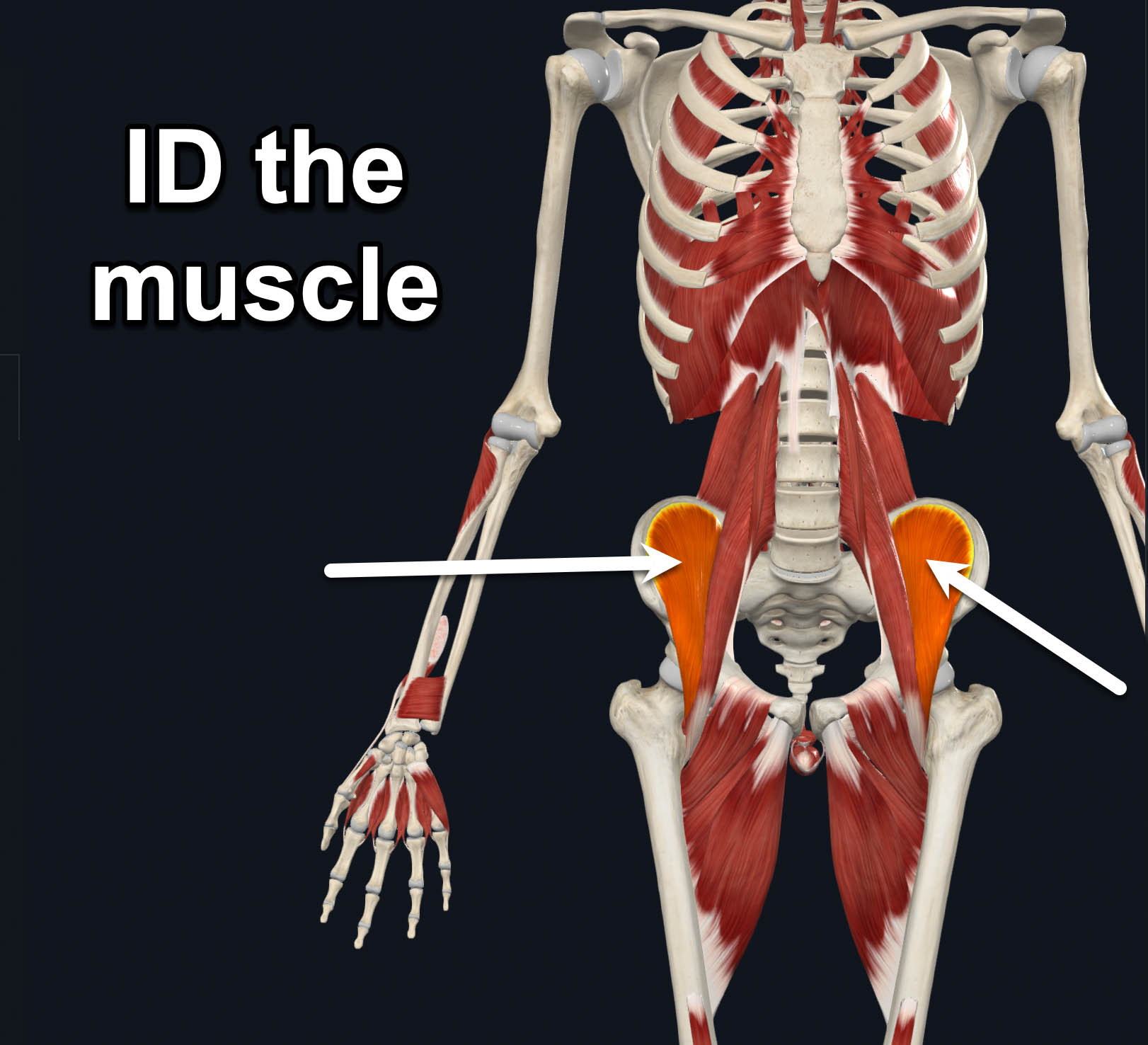 term image