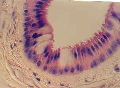 <p>Can be found in gland ducts</p>