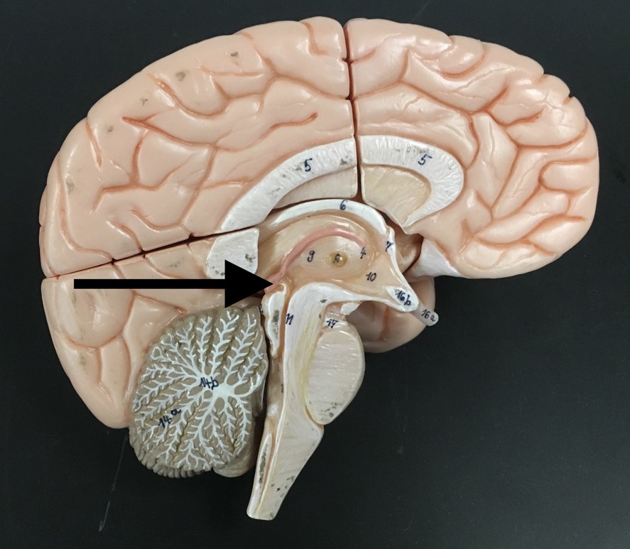 <p>What is the pink bulb the arrow is pointing to?</p>