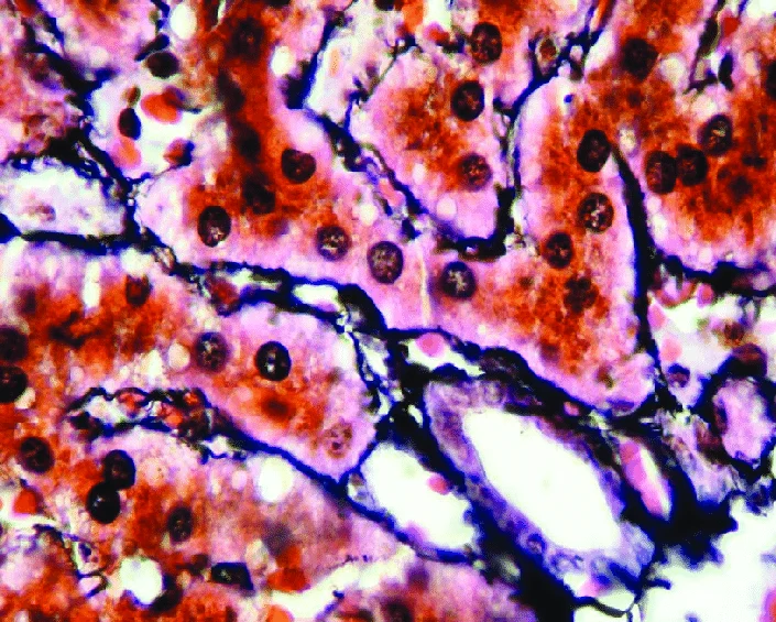 <p><strong>FIBRAS RETICULARES (GENERALIDADES) </strong></p>