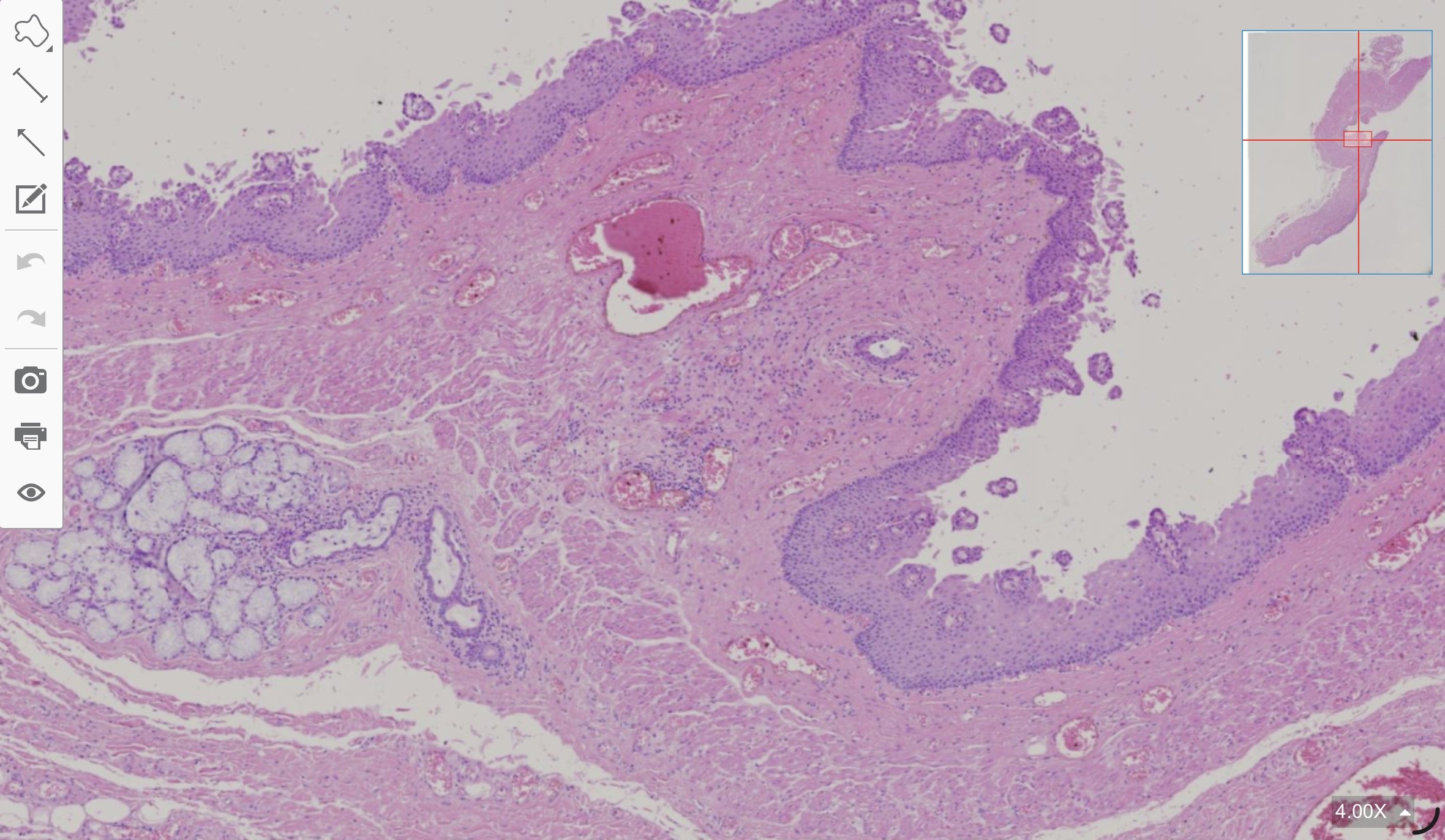 term image