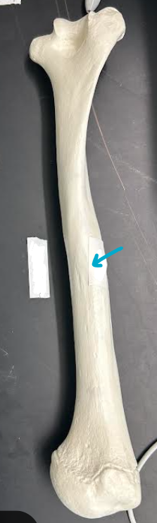 <p>ID humerus region </p>