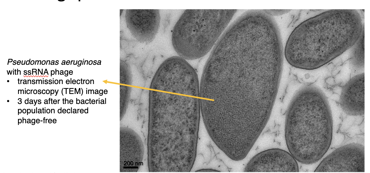 <p>TEM image of Pseudomonas aeruginosa with ssRNA phage</p><p>→ 3 days after <u>bacterial population declared phage-free</u></p>