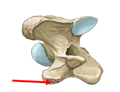 <p>Q: The 6th cervical vertebrae (C6) possesses a …… than C3, C4, and C5. </p><p>A. shorter spinous process </p><p>B. higher spinous process </p><p>C. smaller transverse process </p><p>D. wider transverse process</p>
