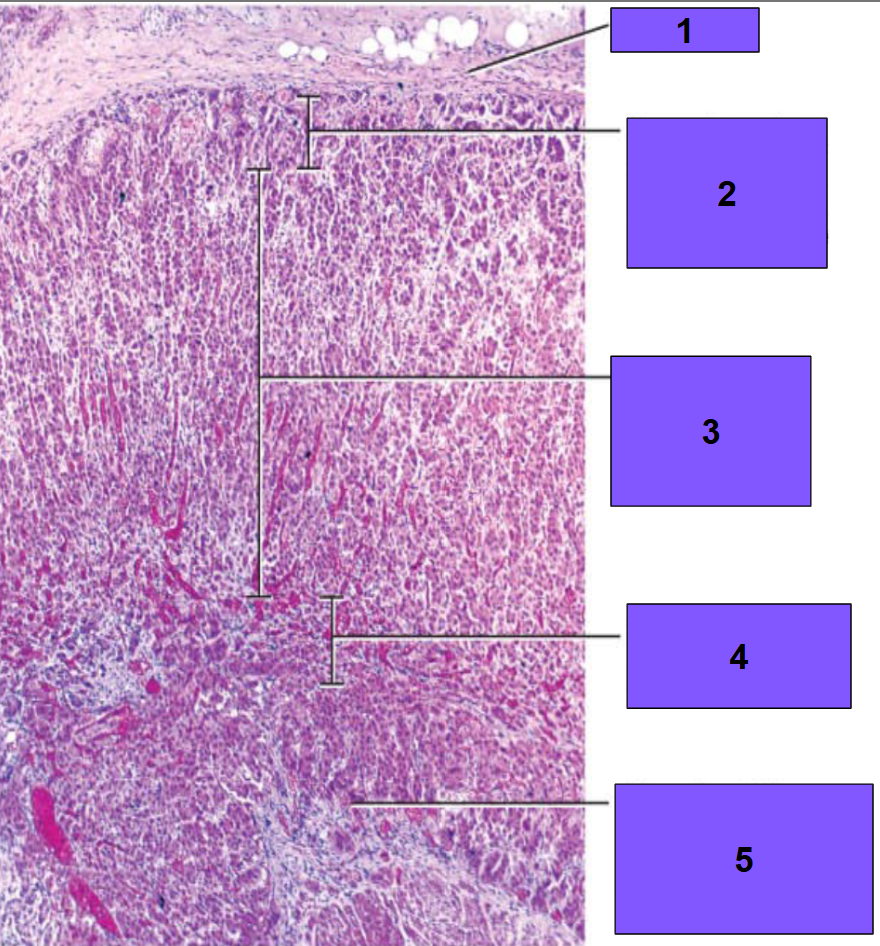 <p>Label the sections and zones</p>