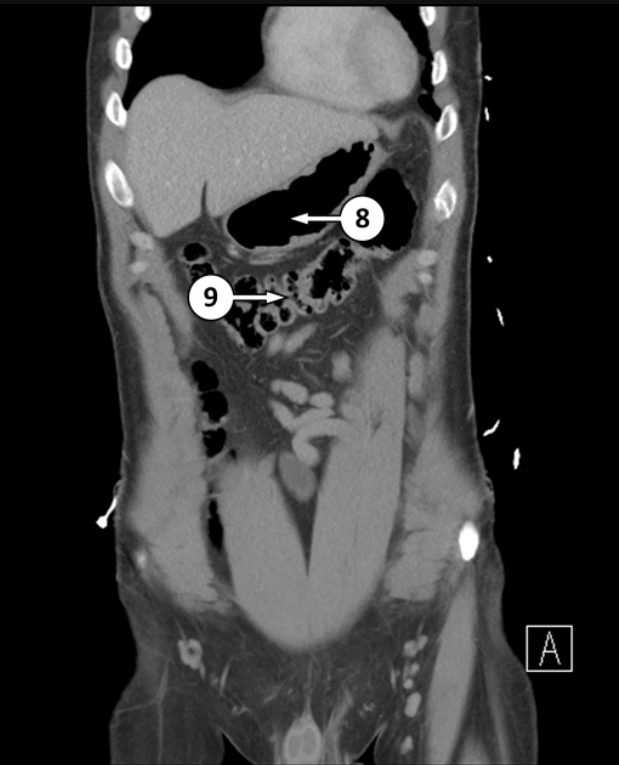 <p>Please label what 8 and 9 is, and what type of epithelium they are</p>