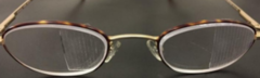 <p>what is this visual field expansion technique?</p>
