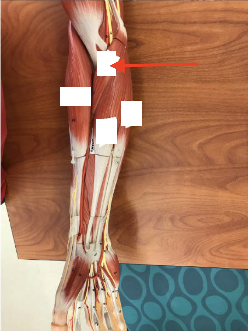 <p>Pronator Teres</p>