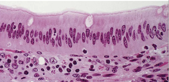 term image