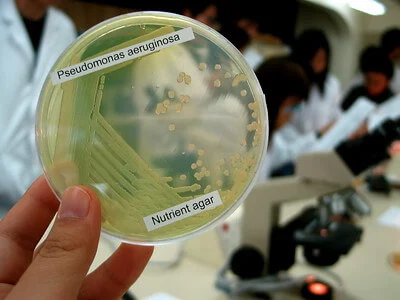 <p><mark>large, flat, opaque colonies with irregular margins and a spreading edge</mark>. The colonies typically emit a sweet, fruity, or grape-like odor. They frequently produce diffusible pigments that color the agar, most notably the blue-green <em>pyocyanin</em> and the yellow-green <em>pyoverdine</em></p>