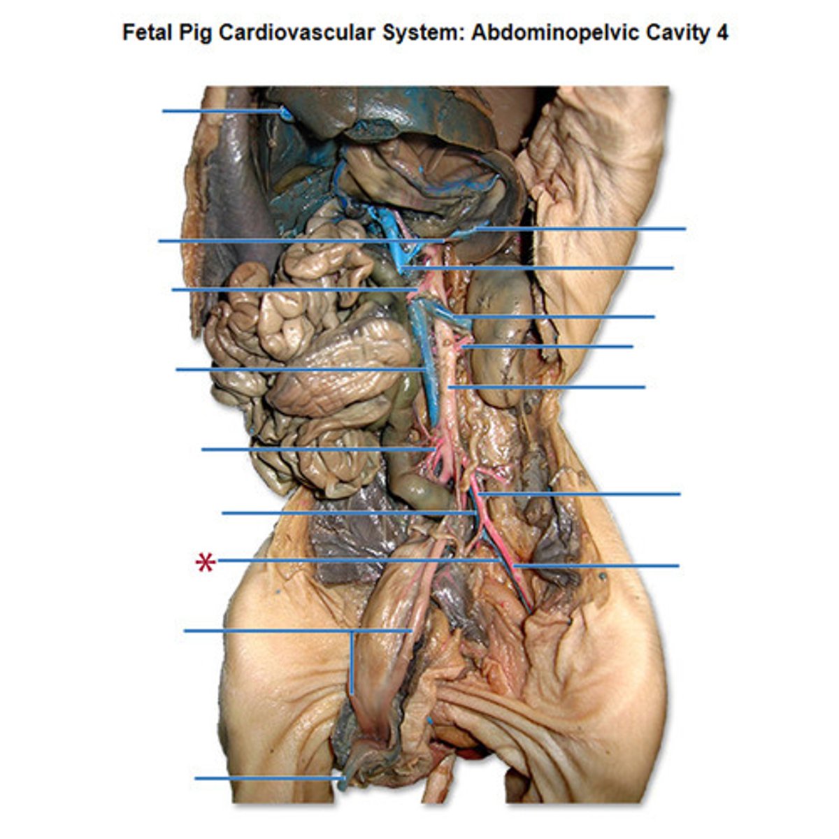 <p>pertaining to the thigh (starred in pic)</p>