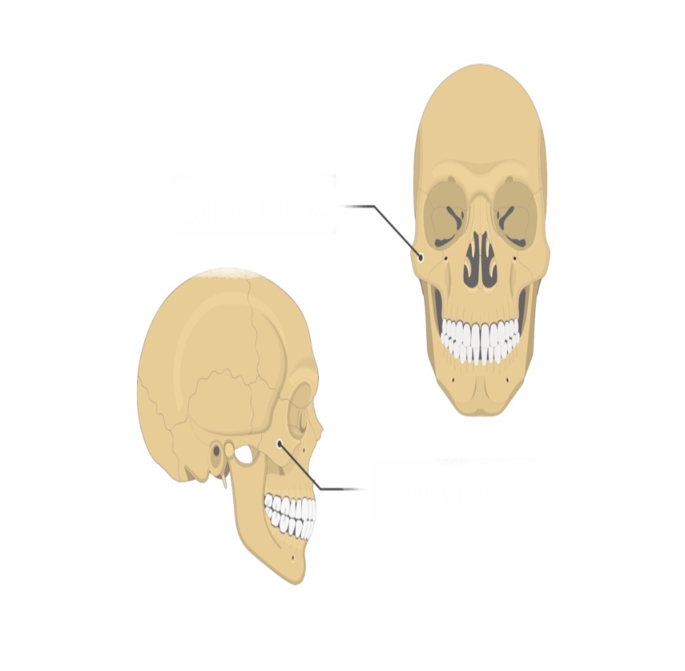 <p>Zygomatic bone</p>