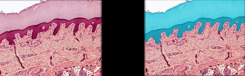 <p>what epithelium is this and where is it located</p>