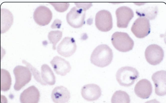 <p>what type of inclusion is this?</p>
