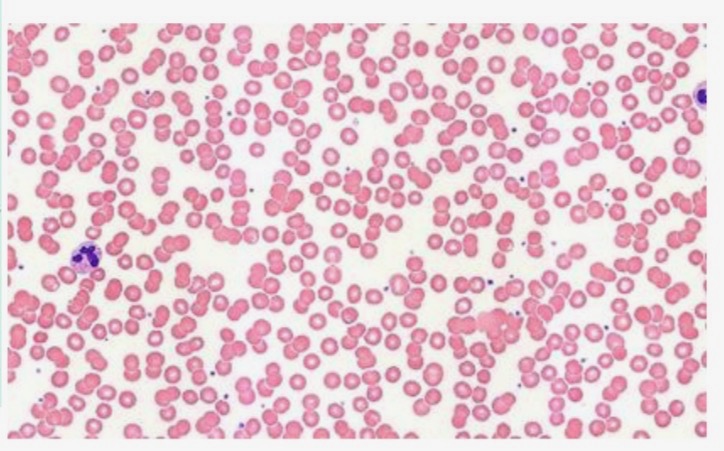 <p>Normal Blood of healthy male</p>