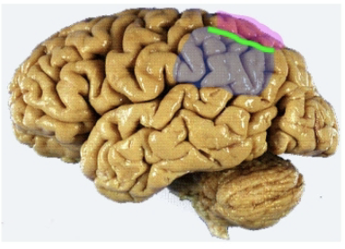 <p><mark data-color="#e016d8" style="background-color: rgb(224, 22, 216); color: inherit;">Superior</mark> and <mark data-color="blue" style="background-color: blue; color: inherit;">inferior</mark> lobules</p><ul><li><p>Separated by the<mark data-color="green" style="background-color: green; color: inherit;"> intraparietal sulcus.</mark></p></li><li><p>Superior lobule (broadmann areas 5 and 7) integrates somatosensory input from multiple modalities —→ used in motor planning (kinesthetic sense, hand eye, coordination)</p></li><li><p>Project to supplementary motor areas in the frontal lobe. </p></li></ul><p></p>