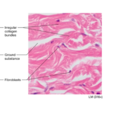 <p>Strucuture</p><p>-collagen fibers in irregular bundles</p><p>-fibroblasts</p><p>-tye-die llings</p><p>Function</p><p>-tensile strength and stretch resistance in MULTIPLE directions</p><p>Location:</p><p>Dermis of skin</p><p>fibrous joint capsue</p>