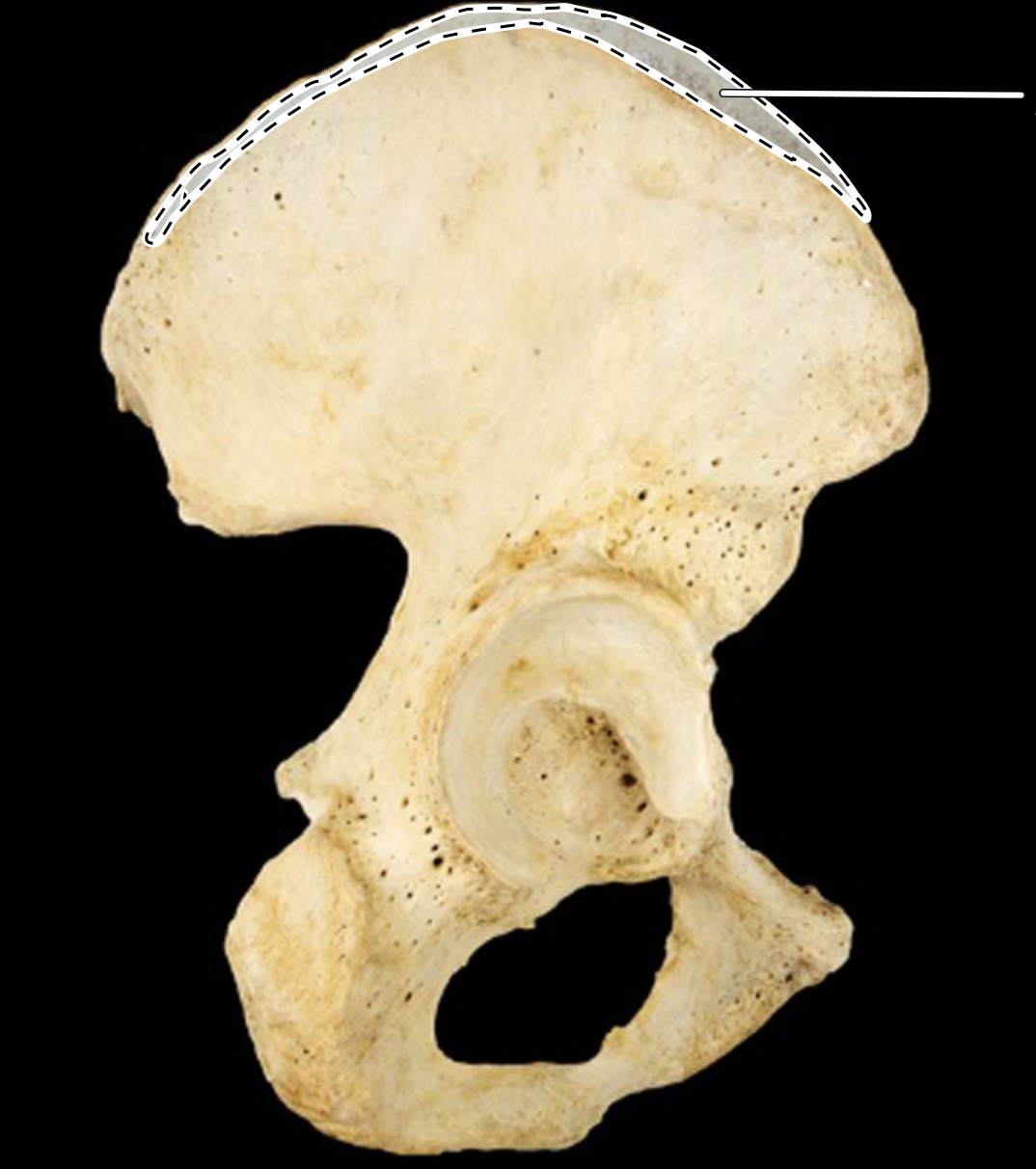 <p>lateral view, right side</p>