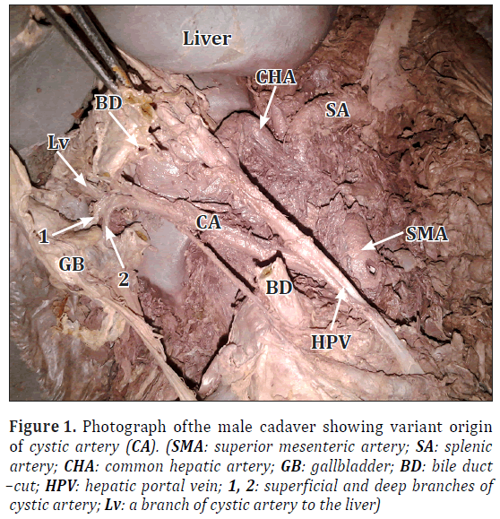 <p>the lower inferior branch coming of the R hepatic artery</p><ul><li><p>structure</p></li></ul><p></p>