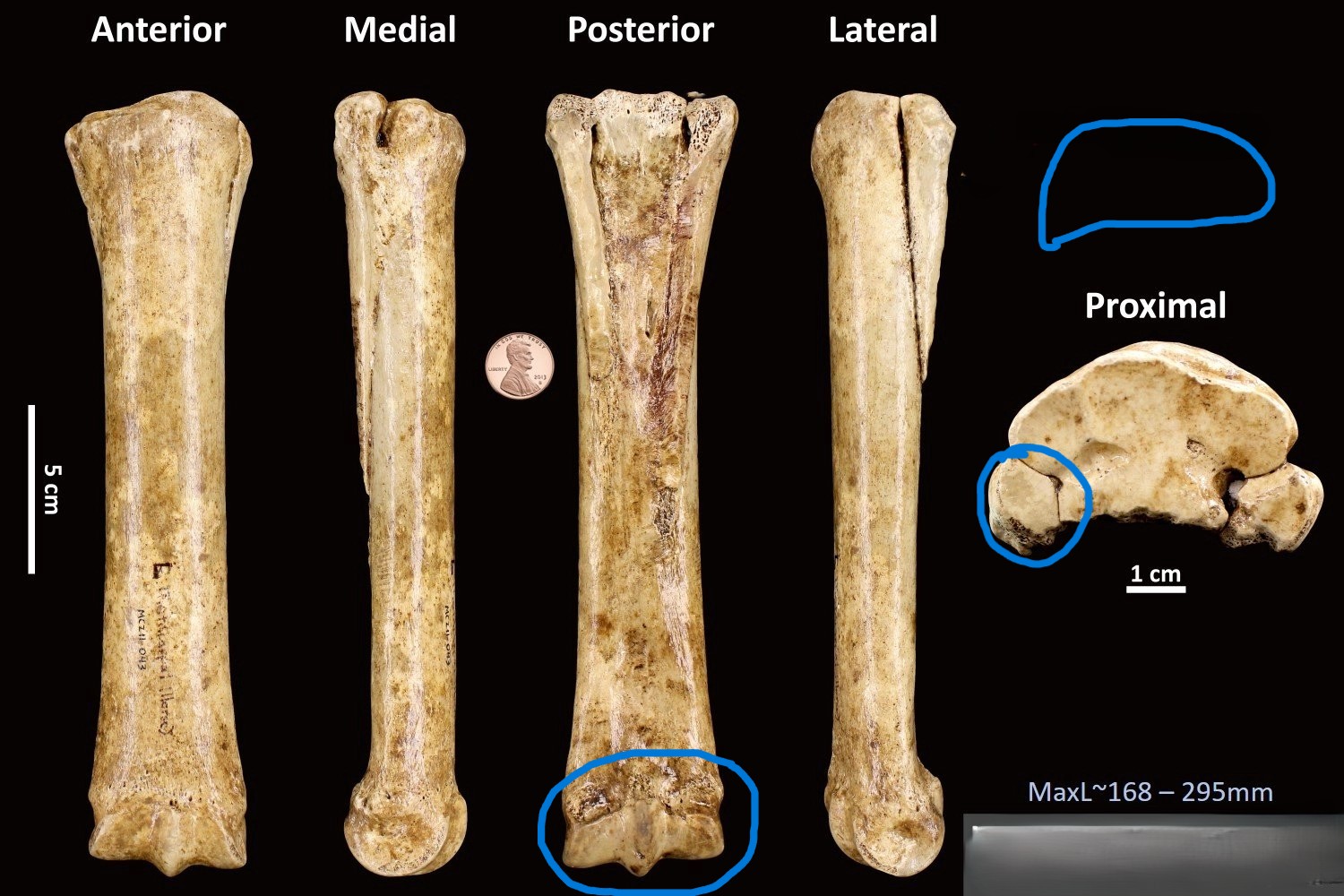 <ul><li><p>single condyle</p></li><li><p>roughly D-shaped </p></li><li><p>may have splint bones </p></li></ul><p></p><p>horse metacarpal</p><p></p>