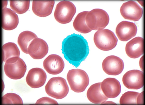<p>Lymphocyte</p>